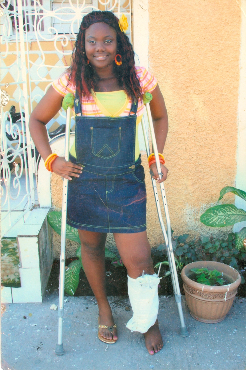 New Lease On Life – Roxanne Johnson Finds Her Way After Losing Leg To Motor Vehicle Crash